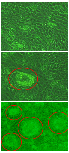 Microscopic images: kidney cells cultivated in microgravity environment (top), kidney cells cultivated in artificial gravitational environment (middle), and kidney cells cultivated on Earth (bottom). Red circles indicate dome structures. (Courtesy: JAXA/University of Tokyo)  