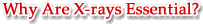 Why Are X-rays Essential?